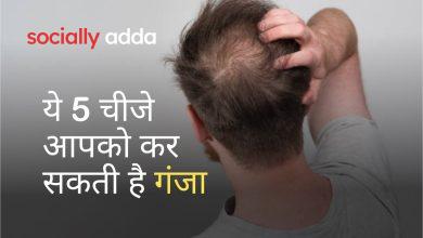 बाल झड़ने के कारण, बाल झड़ने के उपाय, Hairfall reasons in Hindi