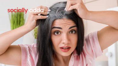 White hair Problem