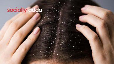 Home Remedies for Dandruff: डैंड्रफ हटाने के घरेलू तरीके, हो जाएगी छुट्टी आज ही अपनाये - Hindi breaking news