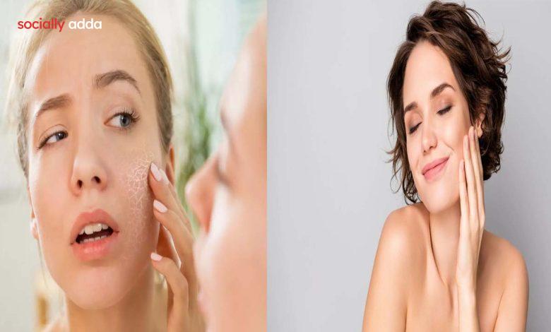 Home Remedy for your face: घर पर बनाएं फेस क्रीम: पाएं चाँद सा निखार - Latest hindi news